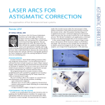 laser arcs for astigmatic correction