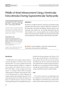 Pitfalls of Atrial Advancement Using a Ventricular Extra