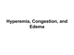 Edema, Hyperemia and Congestion