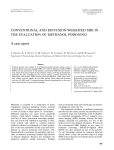 2003-Conventional and diffusion weighted MRI in methanol poisoning