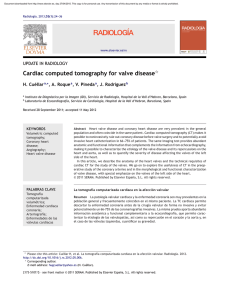 Cardiac computed tomography for valve disease