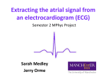 ecg-presentation