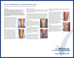 The use of Advazorb on a painful severe ulcer