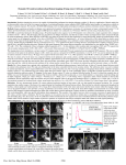 Dynamic 3D contrast-enhanced perfusion imaging of lung cancer