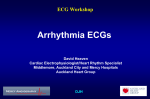 Arrhythmias in ECGs - Auckland Heart Group