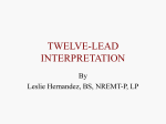 Twelve-lead