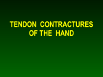 Tendon Contractures of the Hand