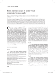 Four curious cases of cone-beam computed tomography