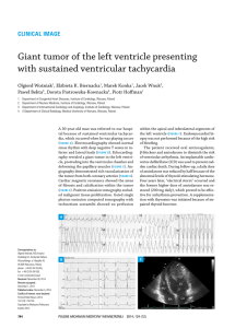Giant tumor of the left ventricle presenting with sustained ventricular