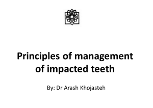 Principles of management of impacted teeth
