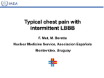 Typical chest pain with intermittent LBBB