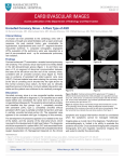 Unroofed Coronary Sinus – A Rare Type of ASD