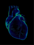 353: Aortic Valve Replacement - Association of Surgical Technologists