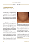 A 17-year-old with Goiter Medical Images