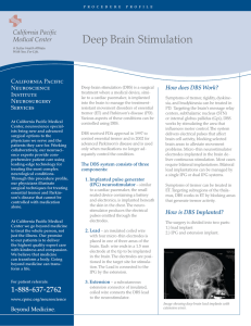 Deep Brain Stimulation - California Pacific Medical Center
