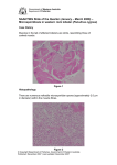 Microsporidiosis in western rock lobster