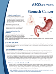 Stomach Cancer