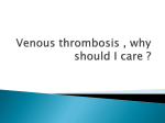 1130 Venous thrombosis Dr Denis O` Keeffe