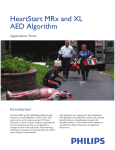 HeartStart MRx and XL AED Algorithm