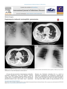 Daptomycin-induced eosinophilic pneumonia