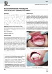 Mucous Membrane Pemphigoid