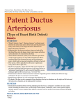 Patent Ductus Arteriosus