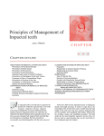 Principles of Management of Impacted teeth