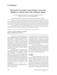 Case Report Movement of an Upper Central Incisor