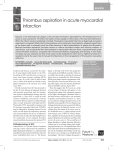 Thrombus aspiration in acute myocardial infarction