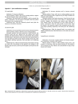 Effect of rotator cuff strengthening as an adjunct to standard care in