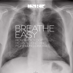 how radiology helps to find and fight lung diseases