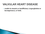 VALVULAR HEART DISEASE