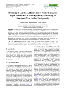 Breaking It Gently: A Rare Case of Arrhythmogenic Right Ventricular