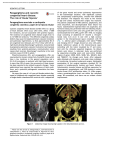 Paraganglioma and cyanotic congenital heart disease: The role of