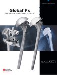 Global FX Shoulder Surgical Technique