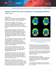 Single Photon Emission Computed Tomography (SPECT) basic level