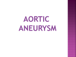 Aortic dissection