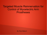 Targeted Muscle Reinnervation for Control of Myoelectric Arm