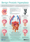 POSTERIOR VIEW OF URINARY SYSTEM, PROSTATE AND