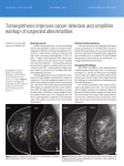 Tomosynthesis improves cancer detection and
