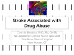 Stroke Associated with Drug Abuse