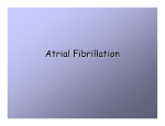 ATRIAL FIBRILLATION