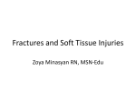 Focus on Fractures