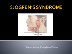 sjogren`s syndrome1