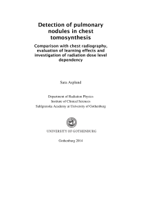 Detection of pulmonary nodules in chest tomosynthesis