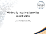 Minimally Invasive Sacroiliac Joint Fusion