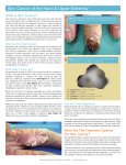 Skin Cancer - American Society for Surgery of the Hand