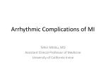 Arrhythmic Complications of MI