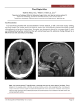 Pineal Region Mass