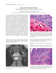 Images in Clinical Tropical Medicine Chronic Schistosomiasis in a